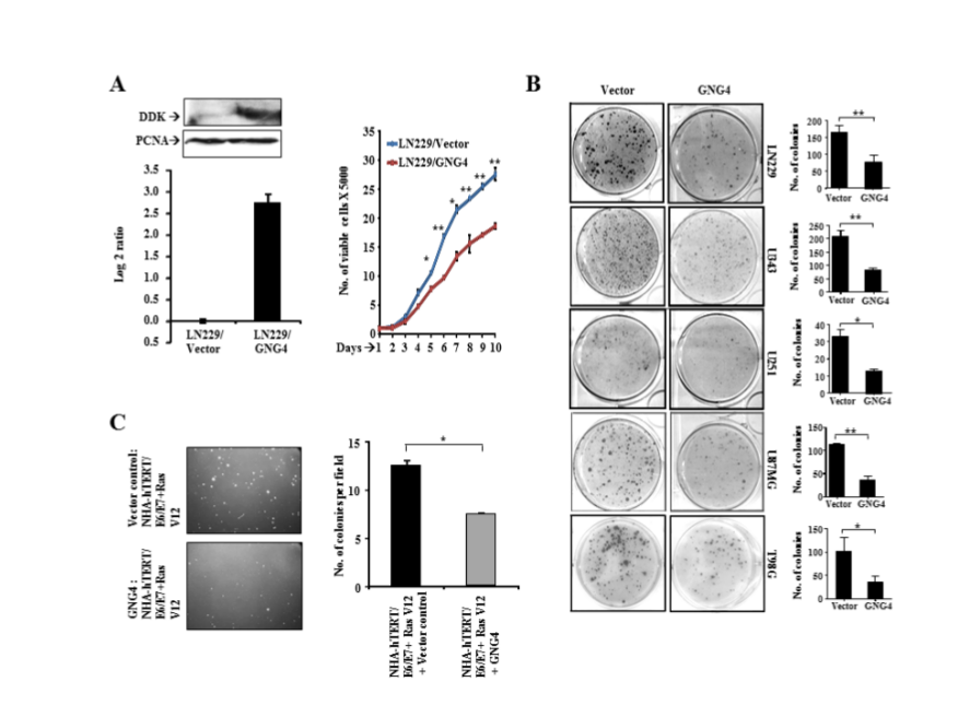 Figure 2:  Effect of GNG4 ectopic overexpression in GBM cell lines. 