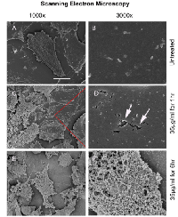 Figure 1: Scanning electron micrograph (SEM) of  the mammary carcinoma cell line 4T1 demonstrates  disintegration of the plasma cell membrane after  treatment with Cypep-1. 