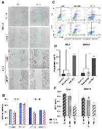 Figure 3:  The effects of the miR-377 on cell migration, apoptosis, and MTT of prostate cancer cell lines. 