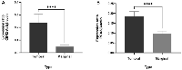 Figure 1: Comparison of CBR3-AS1 and PCA3 expression levels in patients with GC and marginal tissue. 